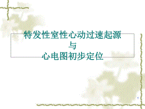 特发性室性心动过速起源与心电图初步定位学习课件.ppt