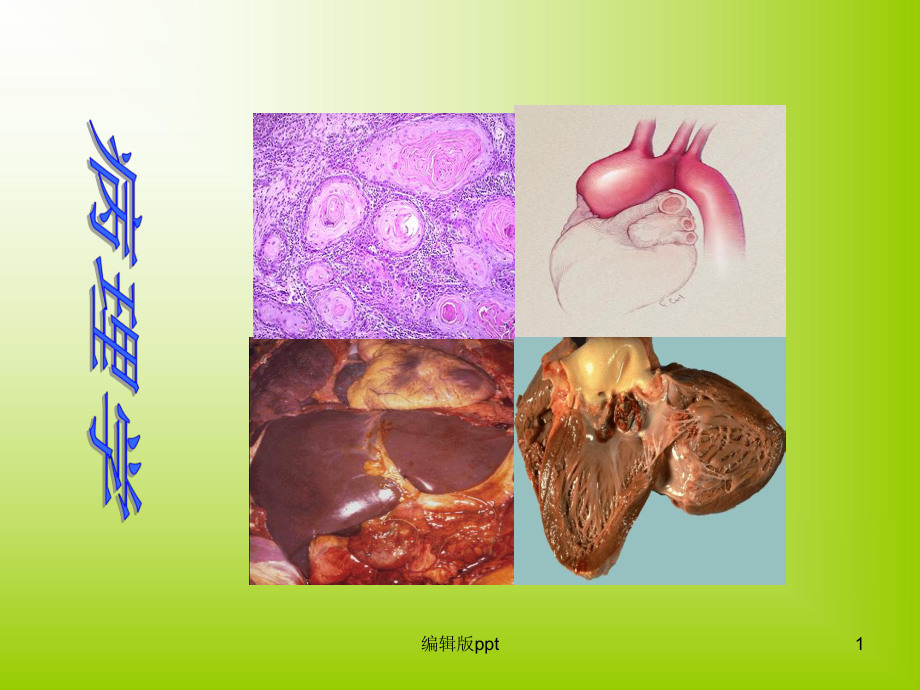 病理学概述疾病概要-课件.ppt_第1页