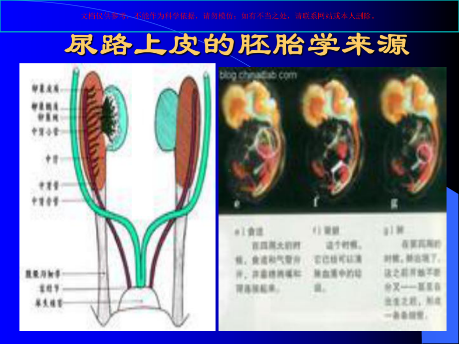 泌尿系统肿瘤专业知识宣讲培训课件.ppt_第3页