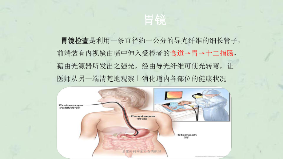 消化内科常见检查的护理课件.ppt_第3页