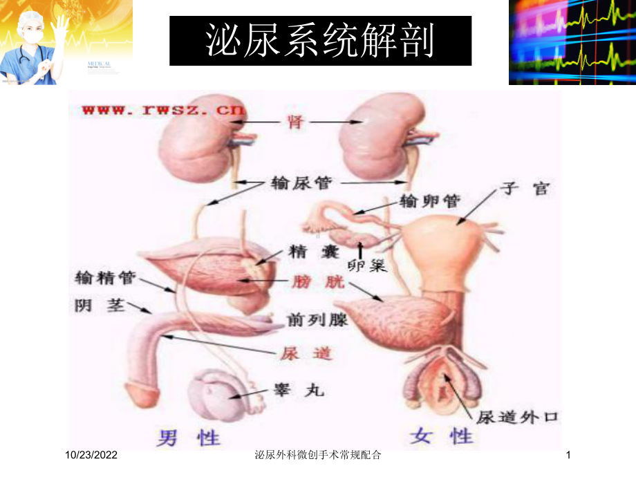 泌尿外科微创手术常规配合培训课件.ppt_第1页