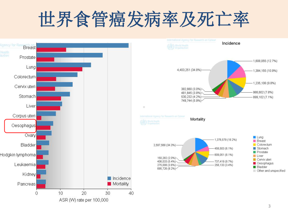 浅表食管癌分层治疗本课件.ppt_第3页