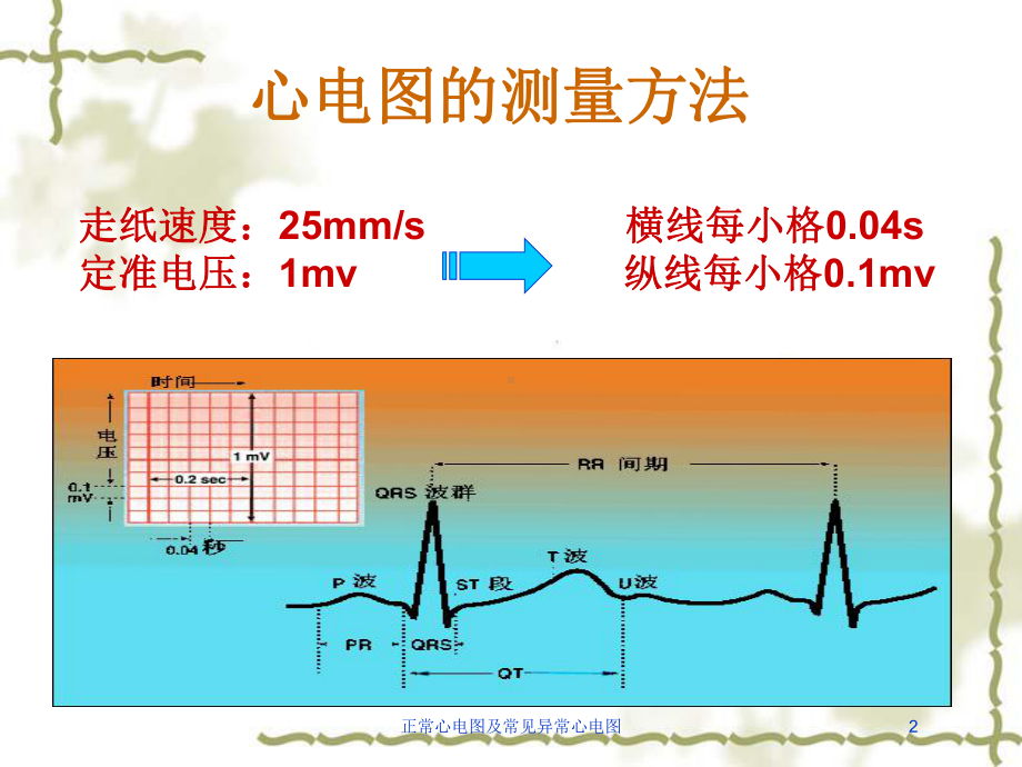 正常心电图及常见异常心电图培训课件.ppt_第2页