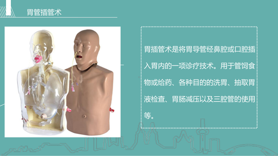 留置胃管的护理培训课件.ppt_第3页