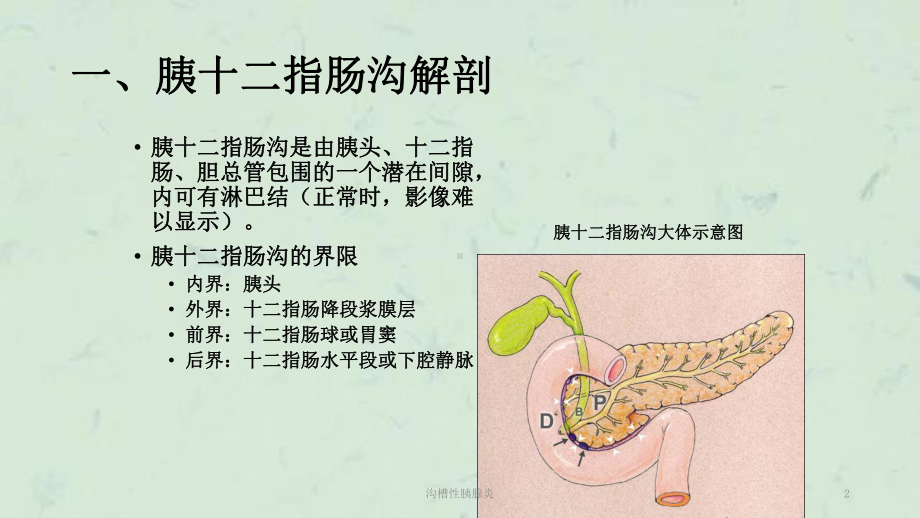 沟槽性胰腺炎课件.ppt_第2页