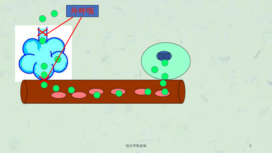 病生呼吸衰竭课件.ppt_第3页