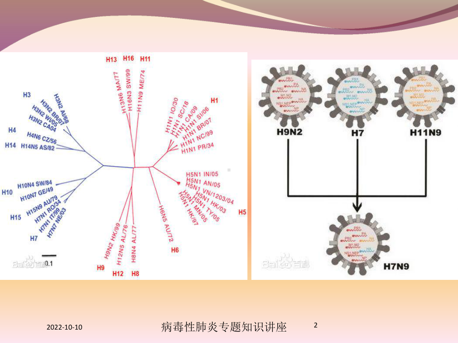 病毒性肺炎专题知识讲座培训课件.ppt_第2页