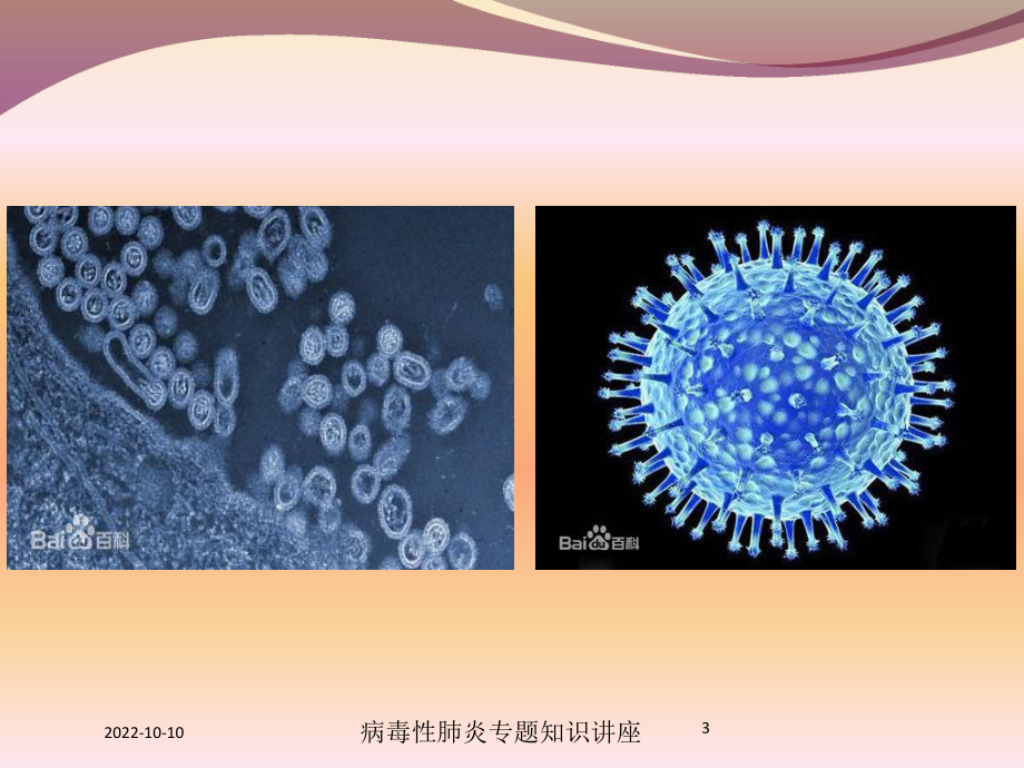 病毒性肺炎专题知识讲座培训课件.ppt_第3页