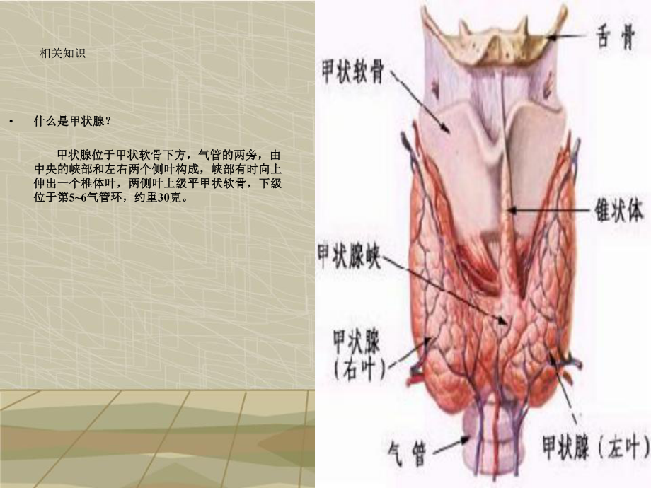 甲状腺癌教学查房课件.ppt_第3页