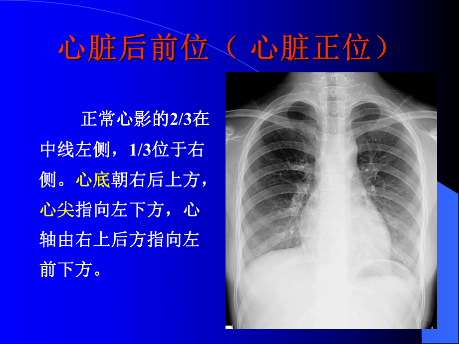 正常心脏大血管的放射学表现课件.ppt_第2页