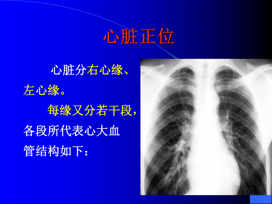 正常心脏大血管的放射学表现课件.ppt_第3页