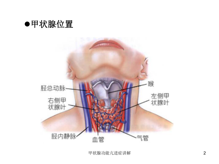 甲状腺功能亢进症讲解培训课件.ppt_第2页