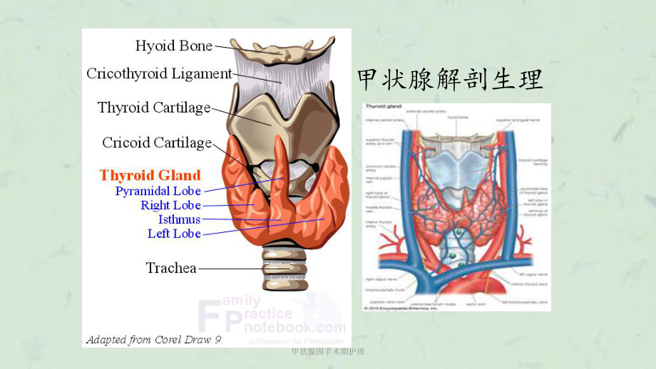 甲状腺围手术期护理课件.ppt_第3页