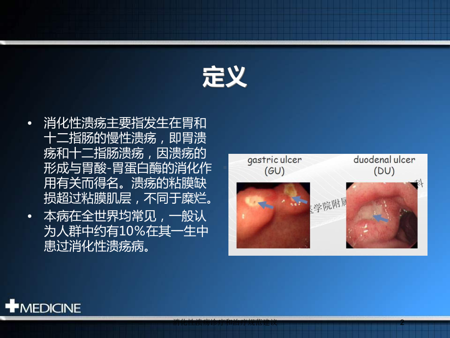 消化性溃疡诊疗和治疗规范建议培训课件.ppt_第2页