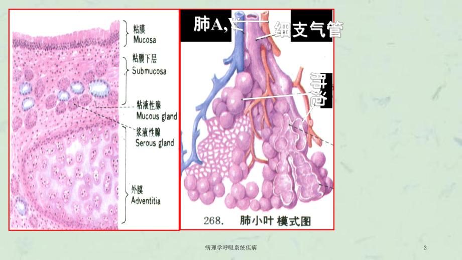 病理学呼吸系统疾病课件.ppt_第3页