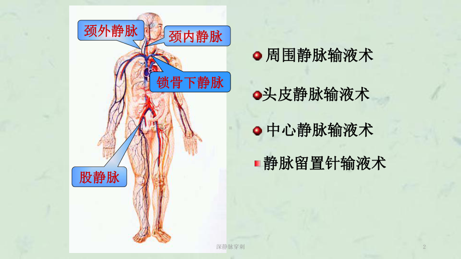 深静脉穿刺课件.ppt_第2页