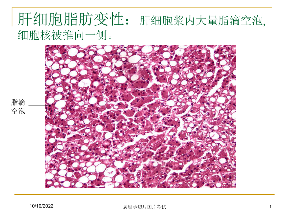 病理学切片图片考试培训课件.ppt_第1页