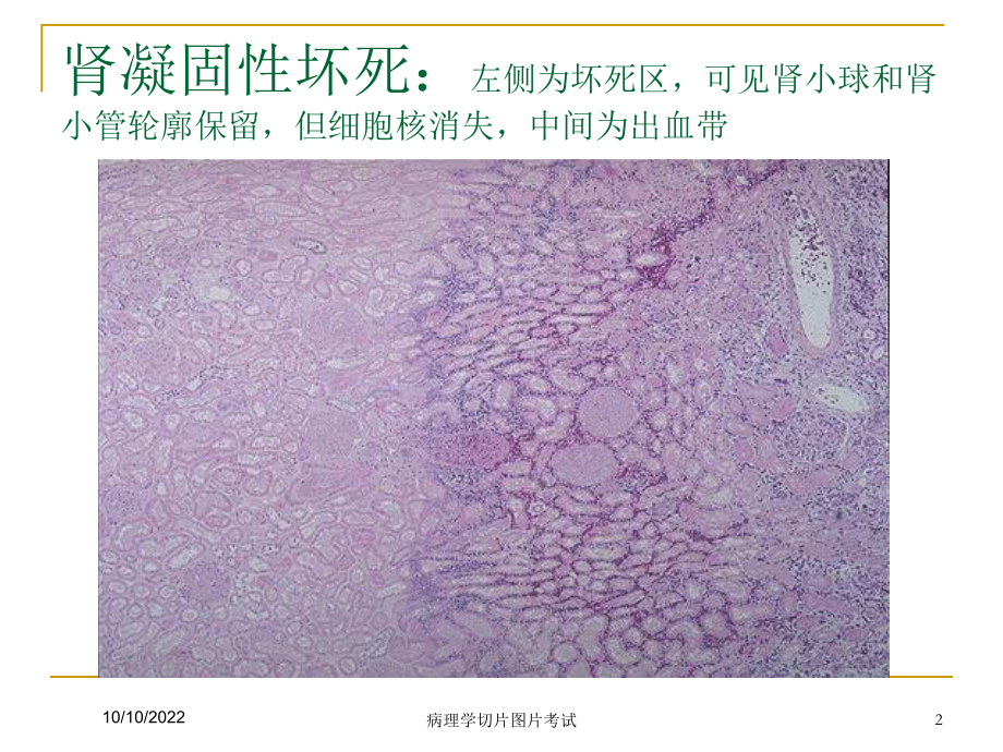 病理学切片图片考试培训课件.ppt_第2页