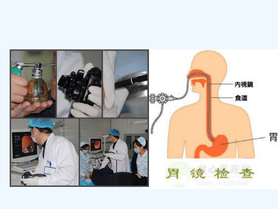 消化内科常见侵入性操作课件.ppt_第3页