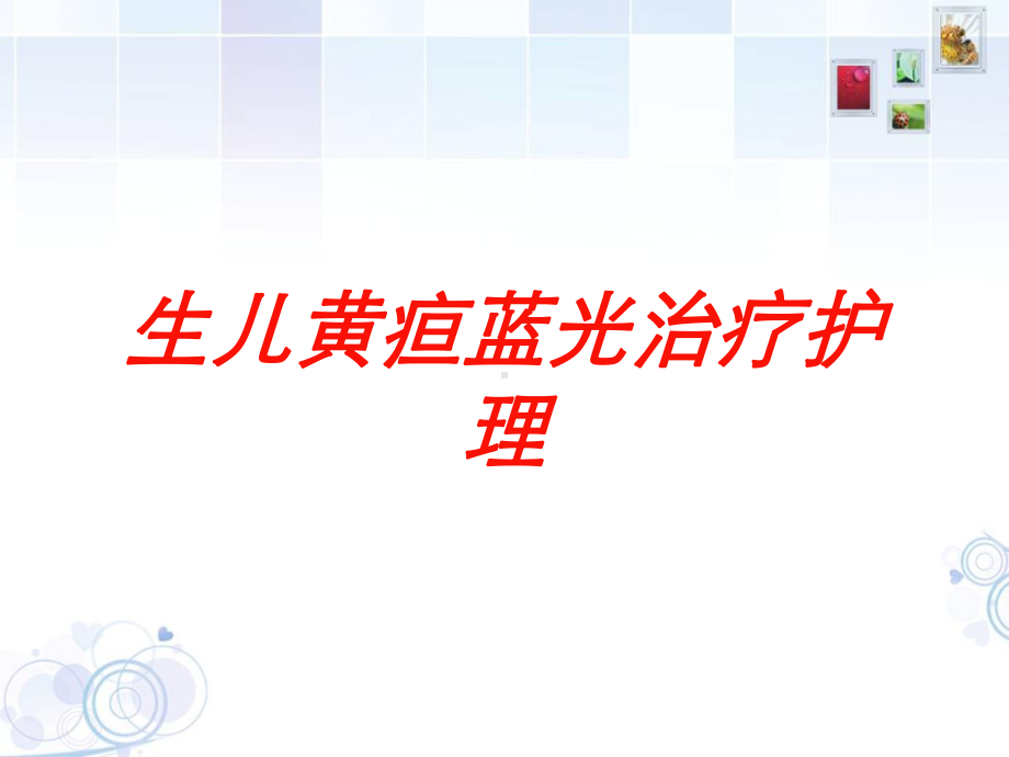 生儿黄疸蓝光治疗护理培训课件.ppt_第1页