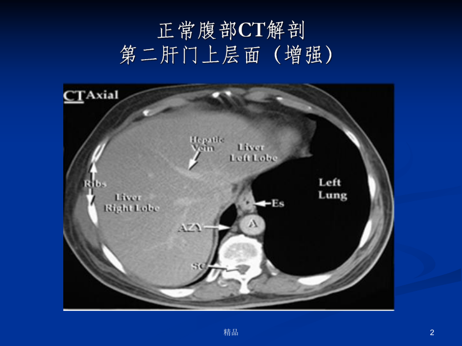 消化系统疾病CT影像阅片基础课件.ppt_第2页