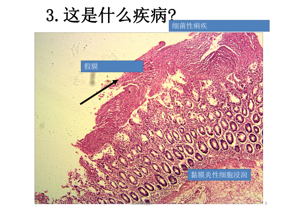 病理切片考试复习课件.pptx_第3页