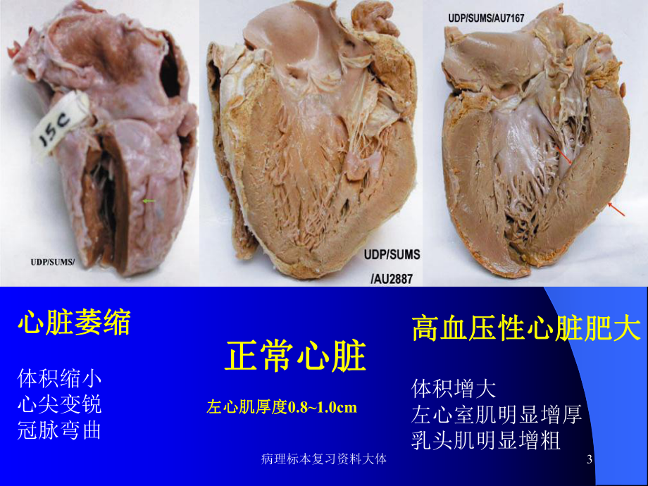 病理标本复习大体课件.ppt_第3页