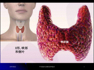 甲状腺局部解剖和临床培训课件.ppt