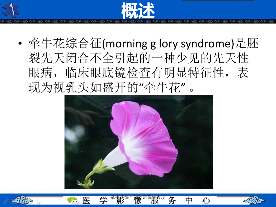 牵牛花综合征的影像学表现课件.ppt_第3页