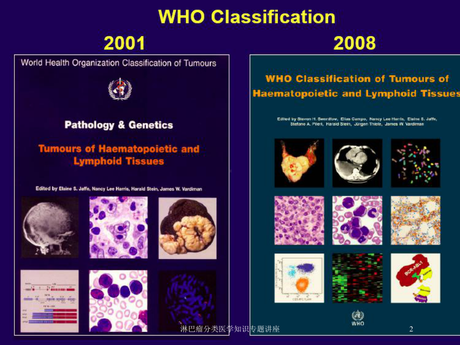 淋巴瘤分类医学知识专题讲座培训课件.ppt_第2页