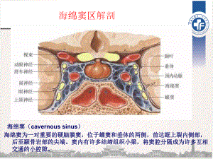 海绵窦区解剖课件.ppt