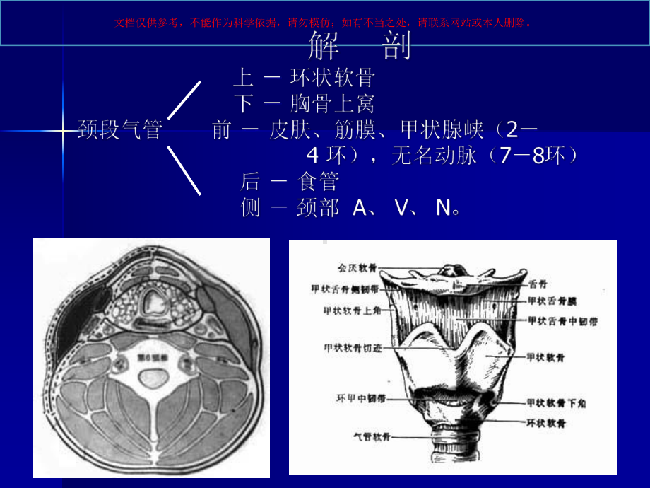 气管切开术临床教学培训课件.ppt_第2页