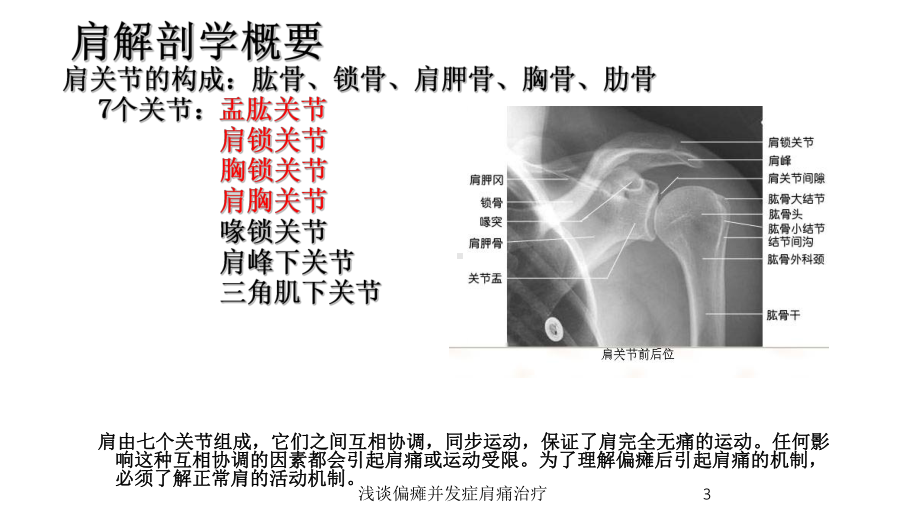 浅谈偏瘫并发症肩痛治疗培训课件.ppt_第3页