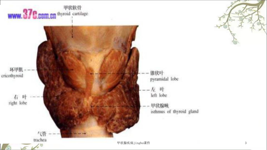 甲状腺疾病jingbu课件.ppt_第3页