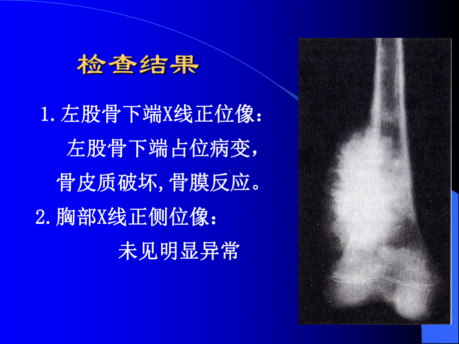 病理学英文课件9.ppt_第3页