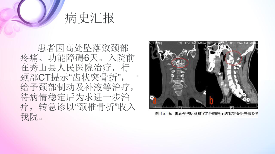 疑难病例讨论颈椎骨折术后培训课件-2.ppt_第3页