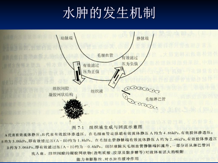 水肿诊断学课件.ppt_第3页