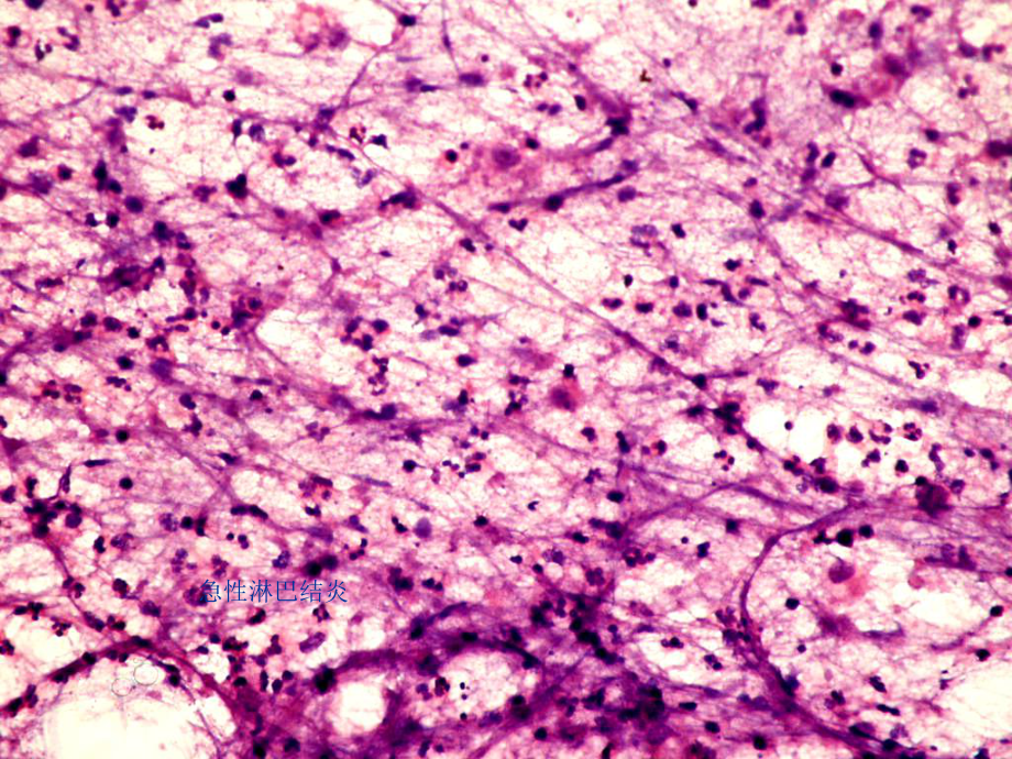 淋巴结针吸细胞病理学课件.ppt_第3页