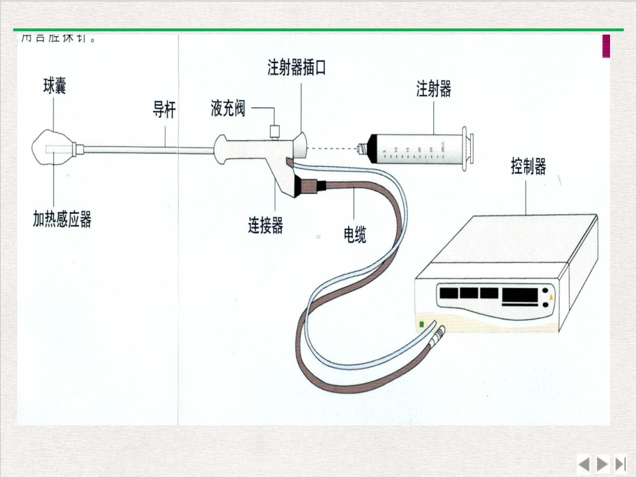 热球法子宫内膜去除术的临床应用优选课件.pptx_第2页