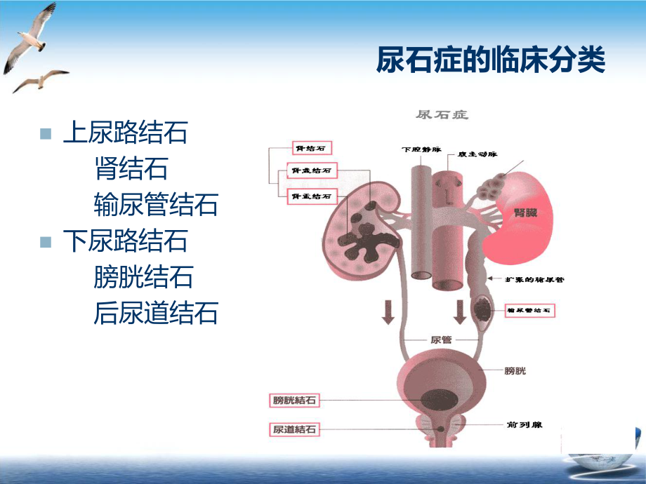 泌尿结石业务学习课件.pptx_第3页