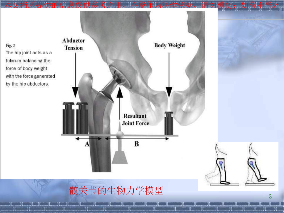 正常髋关节股骨偏心距的影像学研究培训课件.ppt_第3页