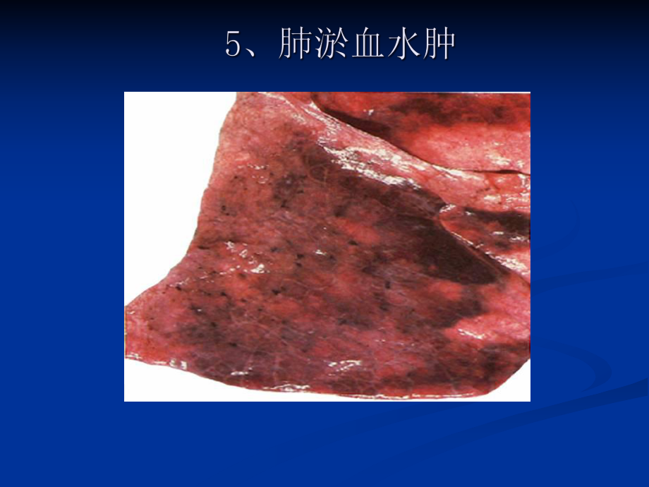 病理学图谱-实验二局部血液循环障碍课件.ppt_第2页