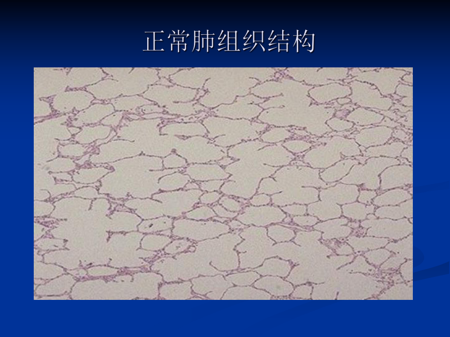 病理学图谱-实验二局部血液循环障碍课件.ppt_第3页