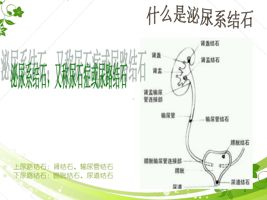 泌尿系结石健康教育-课件.ppt_第2页