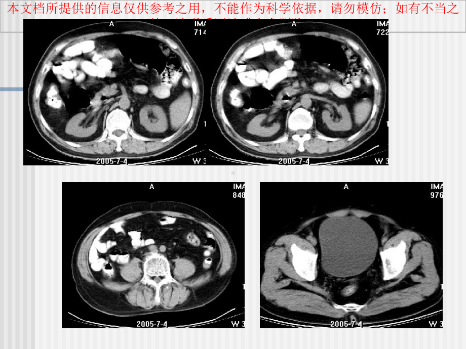 泌尿系统CT检查培训课件.ppt_第2页