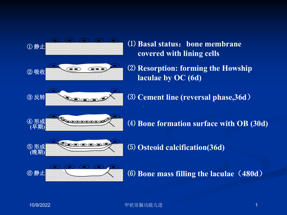 甲状旁腺功能亢进培训课件.ppt_第1页