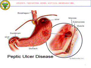 治疗消化性溃疡药培训课件.ppt
