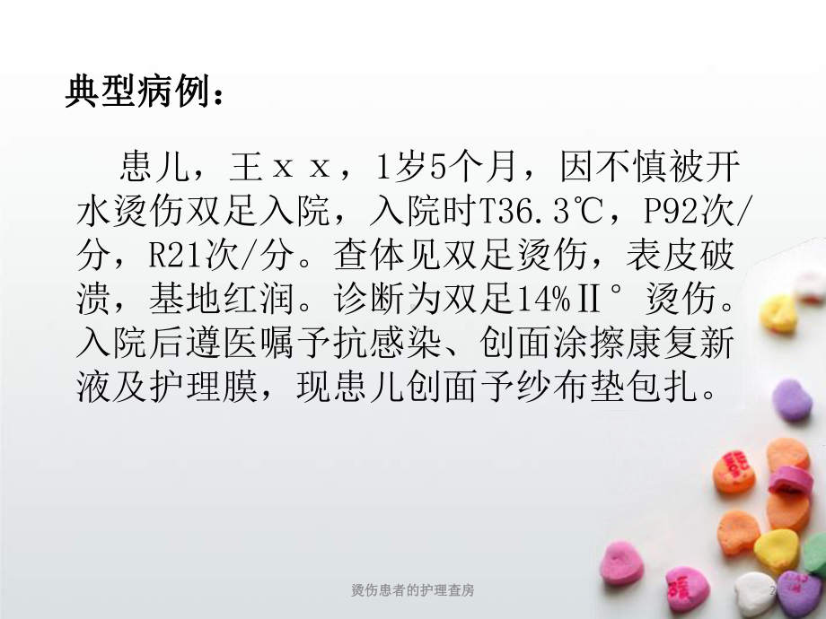 烫伤患者的护理查房培训课件.ppt_第2页