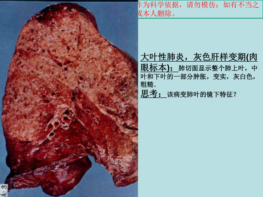 病理实验考试图片培训课件.ppt_第1页