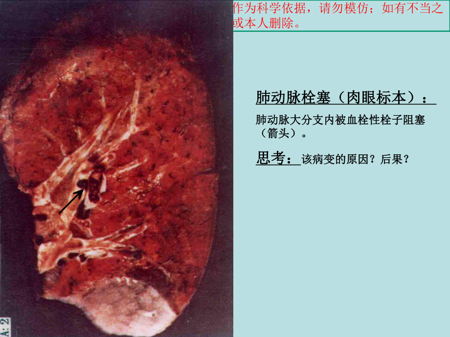 病理实验考试图片培训课件.ppt_第2页